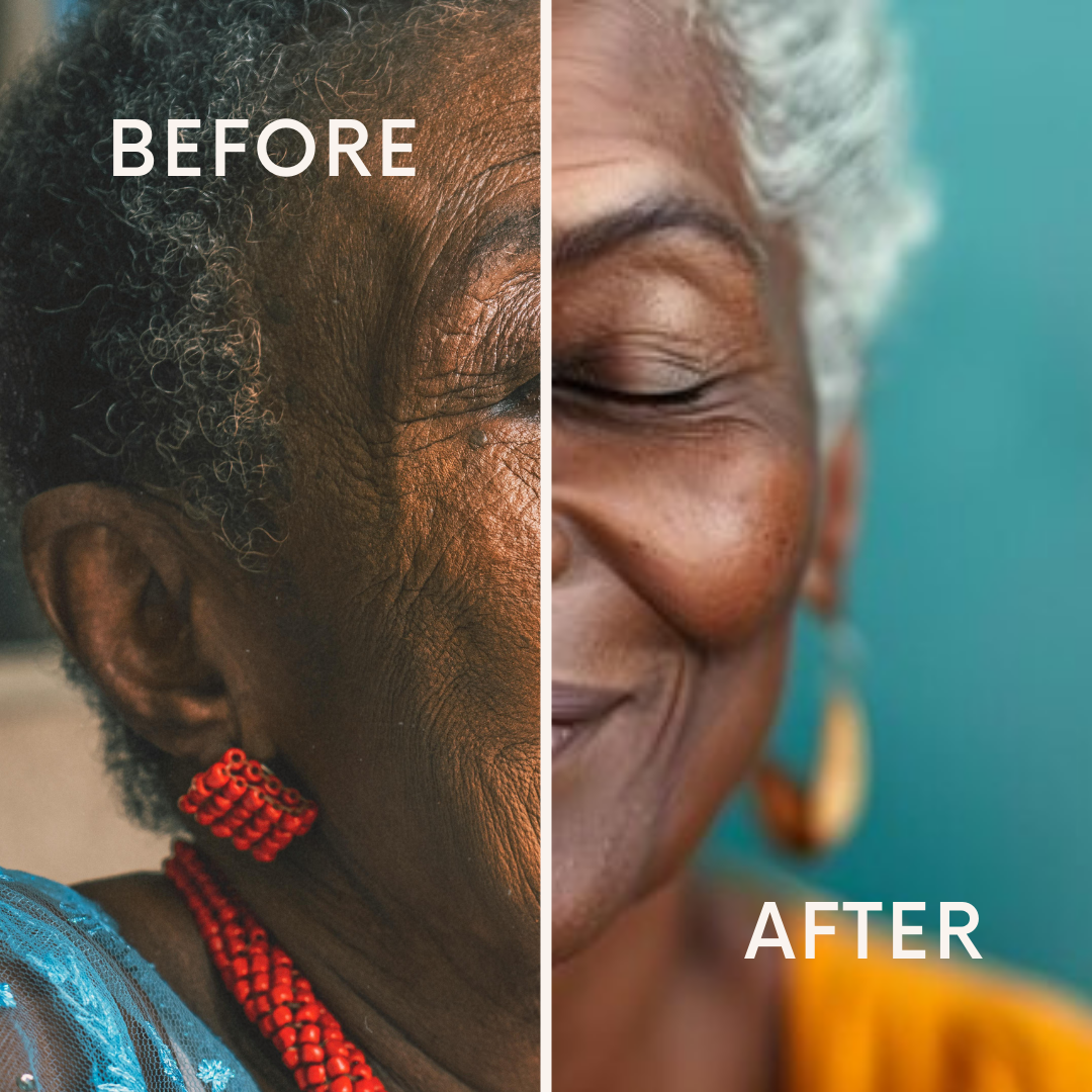 Dramatic before and after wrinkle reduction results